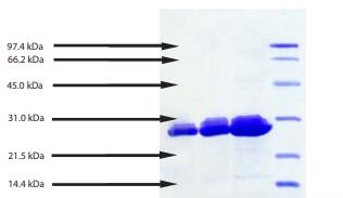 1. PR3 - 5 μg (reduced / heated)<br />2. PR3 - 10 μg (reduced / heated)<br />3. PR3 - 20 μg (reduced / heated)<br />4. LMW Standard